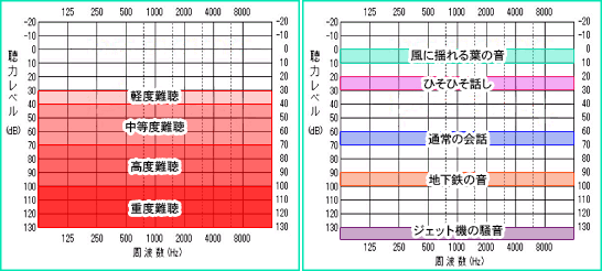 図表【難聴の程度分類】